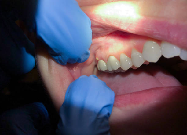 Best Emergency Gum Pain Relief  in Webster Groves, MO